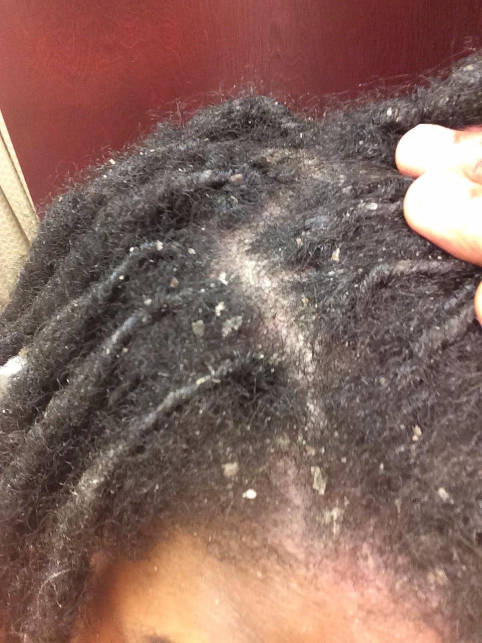 girl on locs
